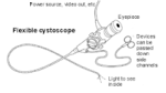 cystopscope